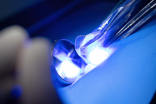 Dental Bonding: An Easy Way To Repair Chips, Cracks, And Gaps