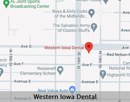 Map image for Root Canal Treatment in Council Bluffs, IA